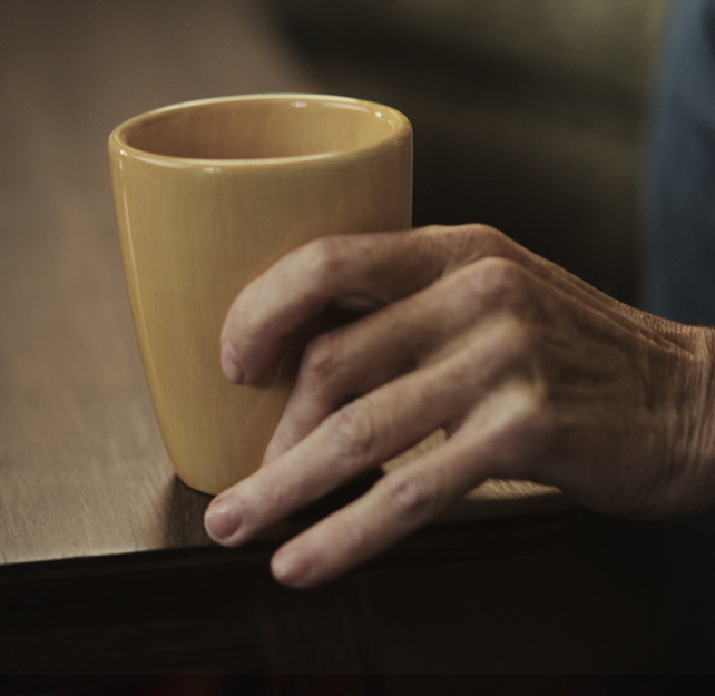 Dupuytren's Contracture hand holding a coffee cup
